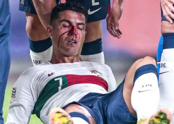 KEADAAN Cristiano Ronaldo selepas cedera akibat bertembung dengan penjaga gol Republik Czech, Tomas Vaclik.