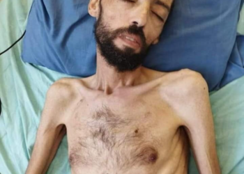 BERAT Khalil Awawdeh kini hanya 37 kilogram. - AGENSI