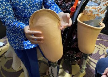 MAJEDA Mohammad Ali Umar (kanan) dan Maryam menunjukkan kaki palsu lama yang tidak lagi sesuai digunakan dan mengharapkan bantuan kaki palsu baharu. Wajah mereka tidak dibenarkan untuk diambil kerana ada pihak yang sudah menyalahgunakannya sebelum ini di media sosial. - FOTO/METRA SYAHRIL MOHAMED