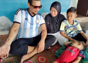 MOHD. Hirwan Kasbi menunjukkan kesan kecederaan di tangan kanannya akibat kemalangan ketika ditemui di Kampung Pilin, Rembau baru-baru ini. – mingguan/NOR AINNA HAMZAH