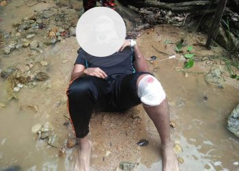 KEADAAN mangsa yang mengalami cedera parah setelah terjatuh ketika mendaki di Air Terjun Gunung Pulai, hari ini