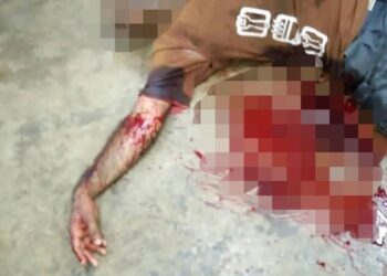 KEADAAN mangsa yang parah ditetak dua lelaki bersenjatakan parang di sebuah kedai runcit di Teluk Intan semalam. - GAMBAR MEDIA SOSIAL