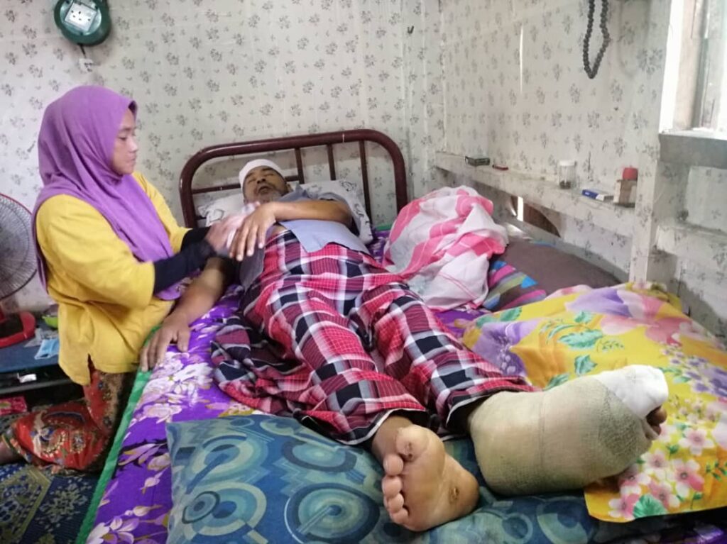 Kaki melecur, membusuk gara-gara bertungku Kaki melecur, membusuk gara-gara bertungku