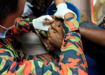 ANGGOTA JBPM Teluk Bahang berjaya memotong cincin yang tersekat di jari manis seorang lelaki berusia 28 tahun di Klinik Kesihatan Teluk Bahang, Pulau Pinang.