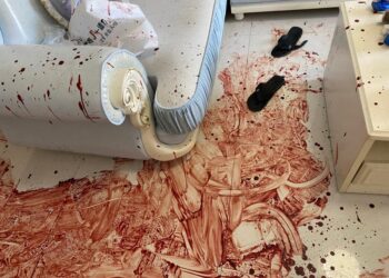 KESAN darah mangsa yang cedera di bahu dan lengan kiri akibat ditikam rakan serumah yang berada di bawah pengaruh alkohol di Forest City, Tanjung Kupang di Iskandar Puteri, Johor.