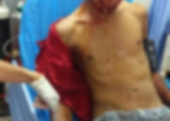 KEADAAN seorang lelaki yang parah ditetak menggunakan golok dan pedang di Kampung Pauh Jabit, Tawang, Bachok petang semalam.
