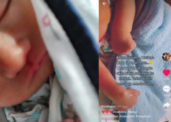 SEBAHAGIAN wajah 'Baby J' bayi kepada Jahidah Nordin yang dikongsikan oleh Fauziah menerusi akaun media sosial miliknya hari ini.