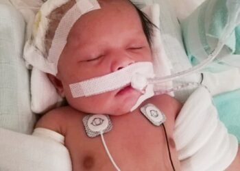 BAYI berusia sebulan, Ayra Inara Alif Imran memerlukan sumbangan orang ramai bagi mengumpul dana menjalani pembedahan jantung berjumlah RM50,000.