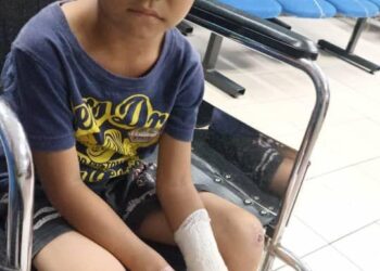 MUHAMMAD Umar Ziyad Zaharudin menjalani pembedahan kecil di Hospital Kemaman akibat diserang kera di kediamannya di Kampung Baru Kuala Abang, di Dungun. - UTUSAN/NIK NUR IZZATUL HAZWANI NIK ADNAN