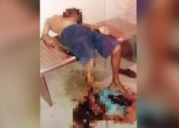 KEADAAN seorang gelandangan di pekan Gemas, Tampin yang cedera di bahagian kaki akibat digigit anjing liar.