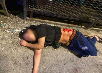 KEADAAN lelaki warga asing ditemukan cedera akibat ditikam di Sri Petaling, Brickfields awal pagi tadi.