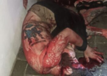 KEADAAN warga Australia dipercayai dipukul sekumpulan lelaki di Jalan Tun Razak, Wangsa Maju.