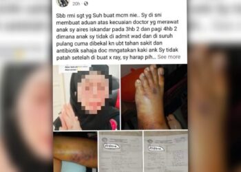 TANGKAP layar hantaran di Facebook oleh seorang wanita yang mendakwa berlaku kecuaian doktor di HTJS di Seremban ketika merawat kaki anaknya.