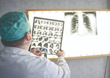 TERDAPAT 20,000 hingga 25,000 kes tibi direkodkan di Malaysia setiap tahun dan paru-paru ialah organ paling kerap diserang.