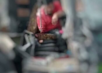 KEADAAN tangan kanan pemandu bas yang putus selepas terlibat dalam kemalangan di 
persimpangan lampu isyarat Jalan Pintasan Kampung Seri Aman, Pasir Puteh, Kelantan petang tadi.-UTUSAN/IHSAN PEMBACA