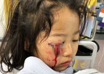 CECILIA Chan tertusuk matanya pada rak logam dan mengenai bahagian kelopak matanya sehingga terkoyak.  - AGENSI