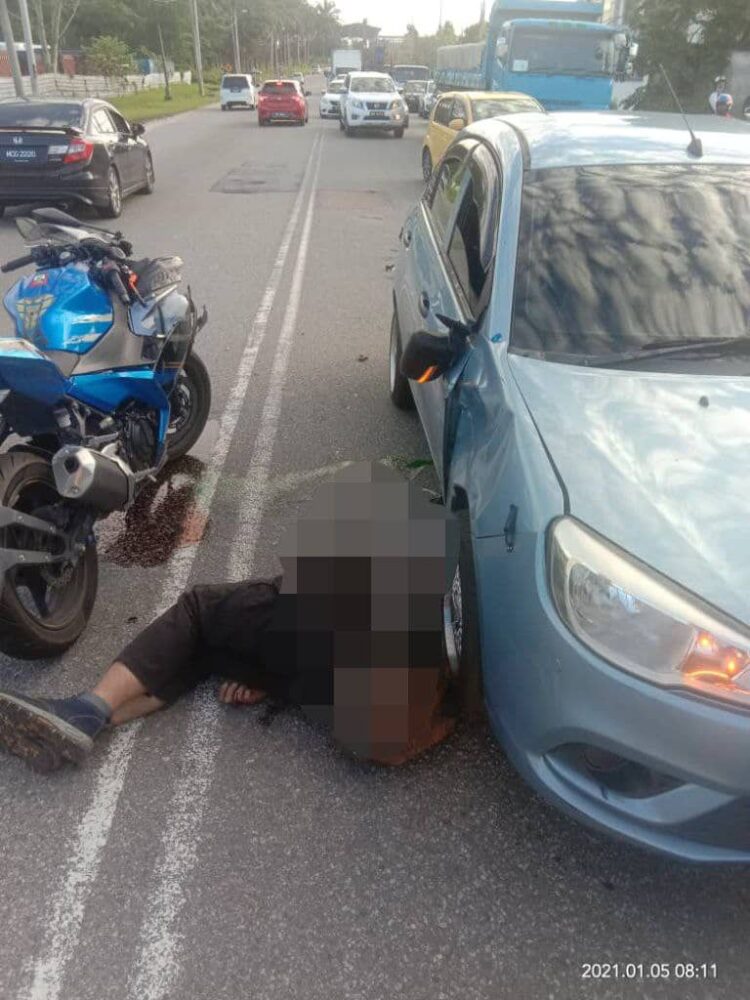 Keadaan Terkini Mangsa Basikal Lajar