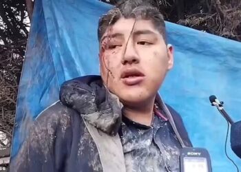 MANGSA menceritakan nasib yang dialaminya selepas berjaya keluar dari keranda di Bolivia.-JAMPRESS