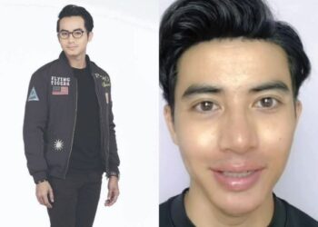 ZOEY Rahman tidak terkesan dengan dakwaan melakukan rawatan botox.