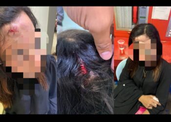 KEADAAN mangsa yang cedera selepas dipukul dan disamun dekat laluan pejalan kaki berhampiran Bangunan Center Point di Klang, Selangor, Selasa lalu.