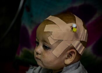 SEORANG kanak-kanak yang cedera akibat gempa bumi diberikan rawatan kecemasan di hospital di bandar Sharan, wilayah Paktika, Afghanistan. - AFP
