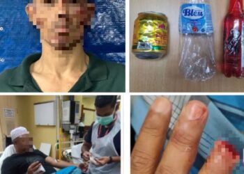 JARI anggota polis putus selepas digigit seorang lelaki yang mengamuk di Balai Polis Cheras.