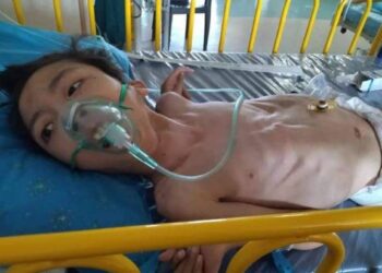 KEADAAN Muhammad Faiz Irfan yang kini bergantung kepada mesin bantuan pernafasan setelah disahkan positif Covid-19 tahap lima selain sengsara dengan pelbagai penyakit lain.