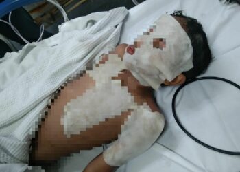 KEADAAN kanak-kanak yang melecur selepas paip berisi asid pecah di sebuah pangsapuri di Seri Kembangan, Selangor. - MEDIA SOSIAL