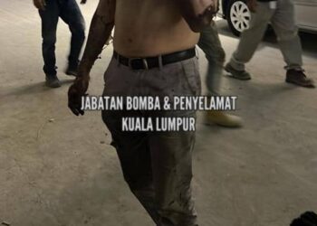 KEADAAN  lelaki yang cedera selepas sebuah kotak suis yang berada di kawasan tapak pembinaan meletup dan terbakar di Jalan Damanlela, Bukit Damansara. - IHSAN BOMBA