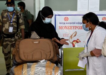 PETUGAS kesihatan memeriksa tangan pesakit sekiranya mempunyai simptom cacar monyet di terminal Lapangan Terbang Antarabangsa Anna di Chennai.-AFP