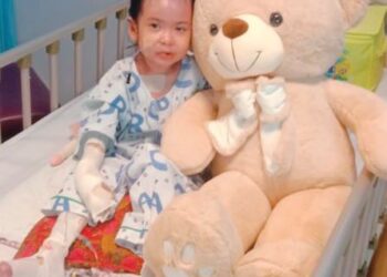 AINA Afieyah Muhamad Nazreen Shah menjalani pembedahan di HRPB bagi memisahkan jarinya yang bercantum akibat luka berulang ekoran penyakit EB atau kulit rapuh yang dialaminya. – IHSAN KELUARGA