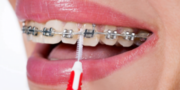 JANGAN sesekali terpengaruh dengan iklan
pendakap gigi palsu kononnya menawarkan
rawatan gigi yang sempurna. – GAMBAR HIASAN