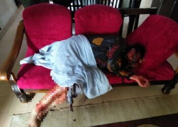 KEADAAN mangsa yang cedera di muka setelah dipukul dengan sebatang kayu oleh suaminya dipercayai akibat cemburu di Ladang Sindora, Layang-Layang di Kluang, Johor.