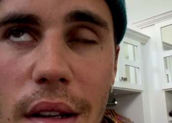 JUSTIN Bieber mendedahkan menghidap sindrom Ramsay Hunt. - AGENSI