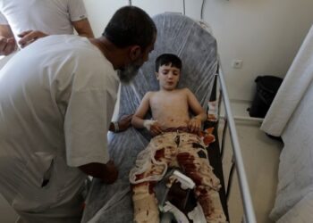 KEADAAN seorang kanak-kanak yang cedera dan dirawat di sebuah hospital selepas berlaku serangan roket di bandar al-Bab, utara Syria. - AFP