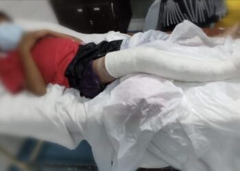 KEADAAN murid tahun tiga yang patah kaki kanan dipercayai dicederakan seorang guru KAFA di sebuah sekolah di Marang, Terengganu, minggu lalu.