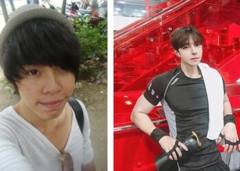 PERBEZAAN ketara seorang lelaki Vietnam sebelum dan selepas menjalani pembedahan plastik.-AGENSI